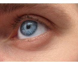 Signs & Symptoms of Parasites in the Eyes | eHow