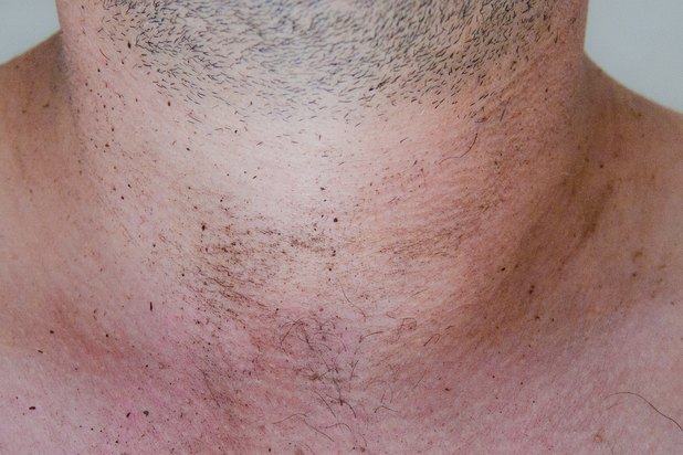 How to Remove Dark Dirty Stains Around the Neck (Photo: Roman 