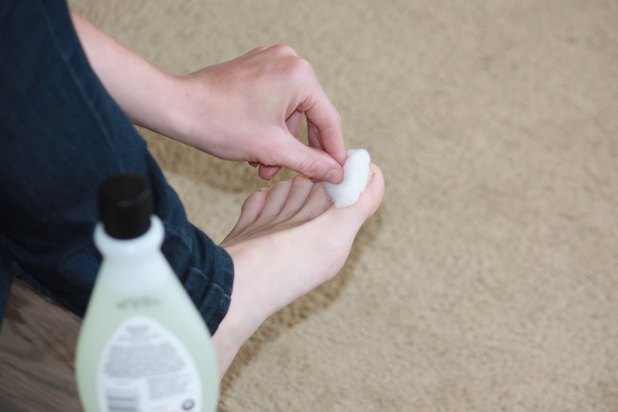 How To Clear Dark Toenails