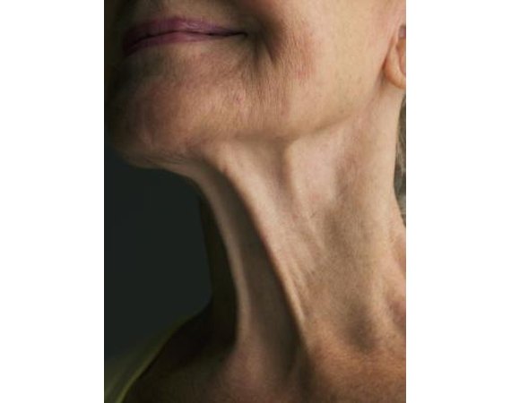 How to Get a Neck Lift  with No Cosmetic Surgery