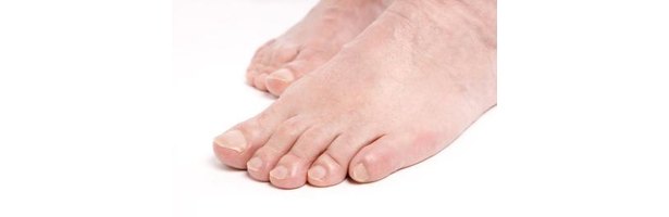 what-causes-skin-to-peel-between-toes-finger-ehow