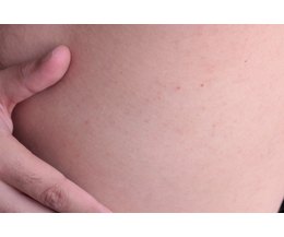 identify skin rash