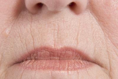 Great Treatment methods intended for Lines and wrinkles Throughout the Lips