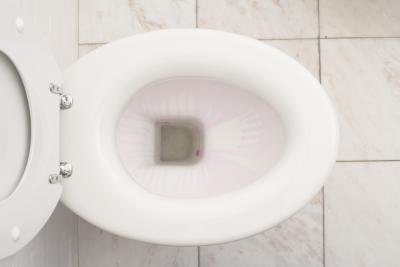 You are not drinking enough water if your urine is dark yellow or gold