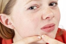 You can eliminate zits from a photo of someone's face with GIMP.