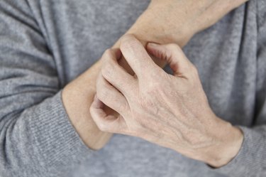 Senior woman scratching arm, close-up