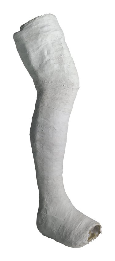 how-to-make-a-fake-leg-cast-without-fiberglass-ehow