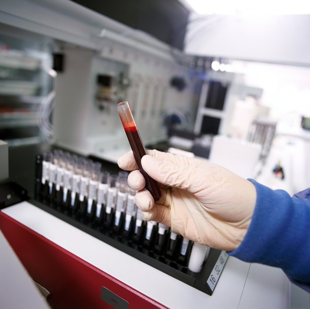 A gloved hand holding a vile of blood in a laboratory