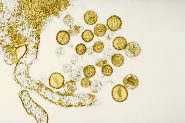 Sin Nombre Virus at 171,000 Magnification