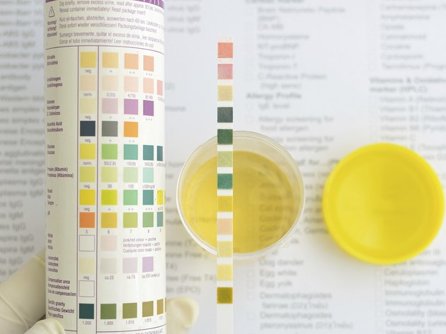 Urine analysis