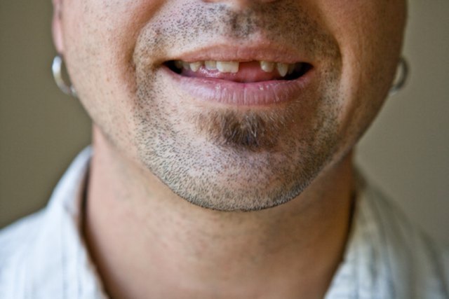 How to Black Out Teeth for a Halloween Costume