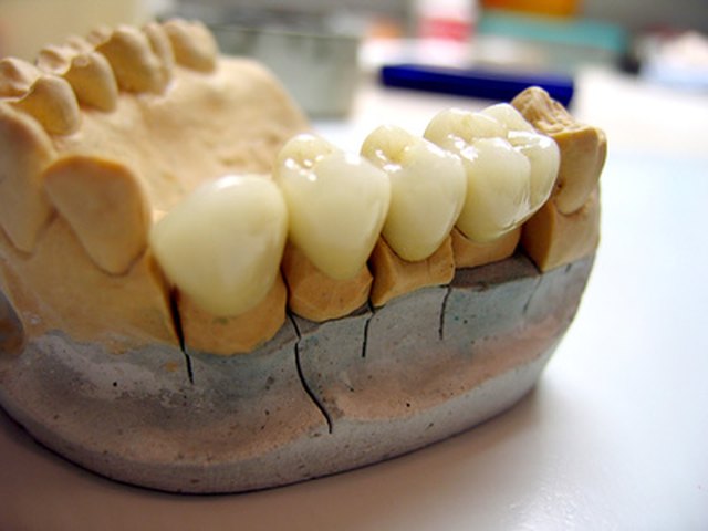 how-to-make-a-pair-of-fake-teeth-ehow