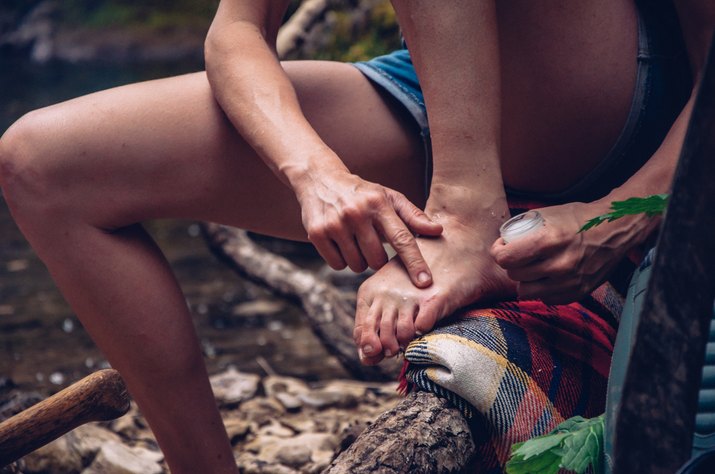 Adult Woman Applying Lotion For Physical Injury