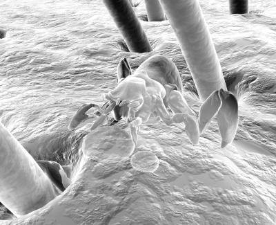 Old Folk Remedies to Kill Hair Mites (with Pictures) | eHow
